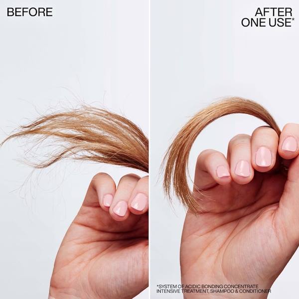 Before-after treatment